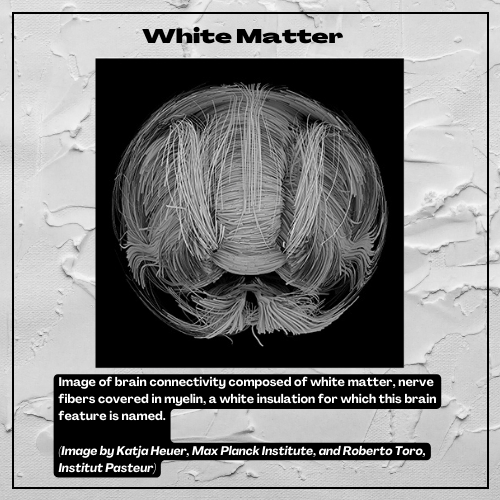 Image of white matter connections, spaghetti-like nerve fibers covered in white myelin insulation for which this brain feature is named